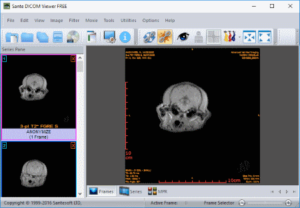 Sante DICOM Viewer Pro 12.2.5 download the new for android